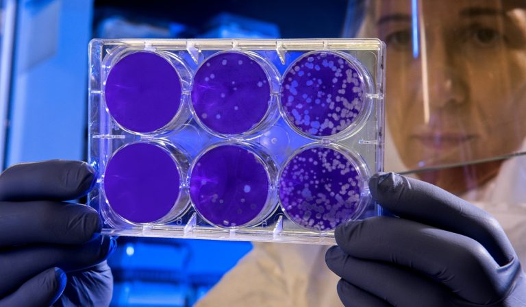 Scientist examines the result of a plaque assay