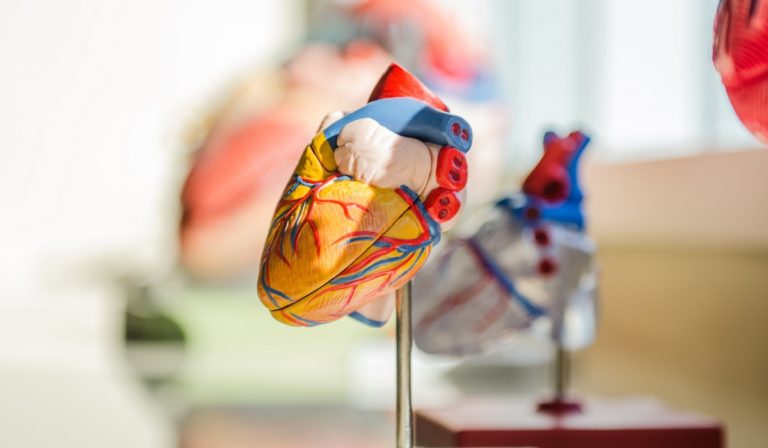 Model of a human heart